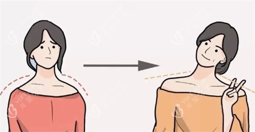 瘦身针前后