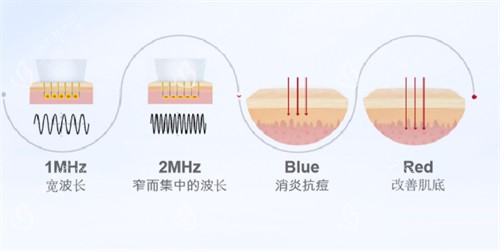 韩国VIVACE第二代白金胶原修复枪功效