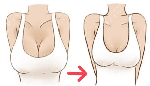 巨乳缩小卡通