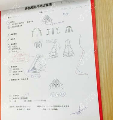 北京柏丽医疗美容医院李劲良做鼻子设计