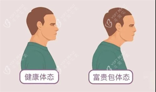 富贵包和健康体态对比动画图