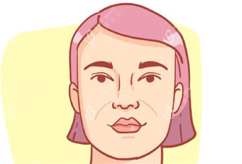 法令纹图片