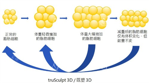 美国既塑3D溶脂原理