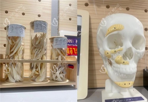 重庆松山医院截骨骨头整理区域图
