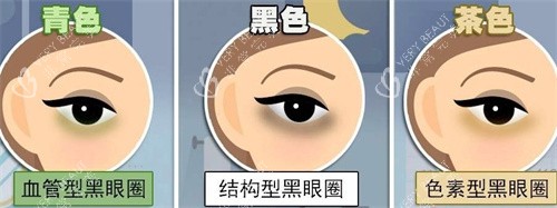 不同的黑眼圈类型