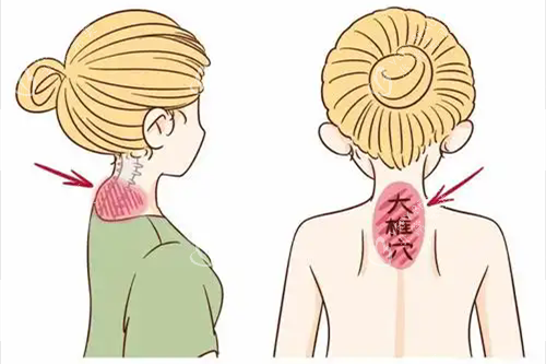 富贵包位置.webp