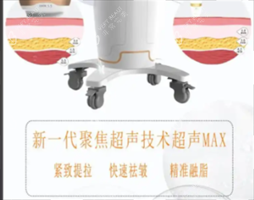 超声max作用