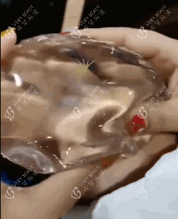 豐胸手術(shù)傲諾拉隆胸假體手感 豐胸手術(shù)傲諾拉隆胸假體手感