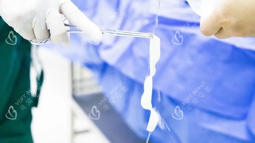 3d生物束带 3d生物束带