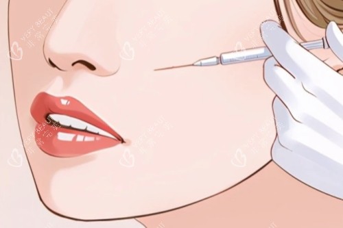 面部注射卡通一览