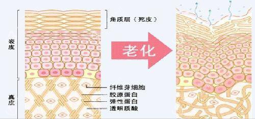 皮膚老化前后內(nèi)部組織形態(tài)示意圖