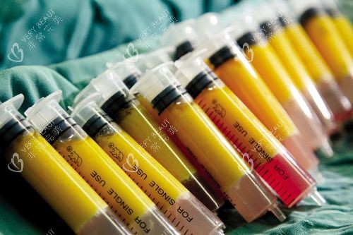 自體脂肪豐胸脂肪