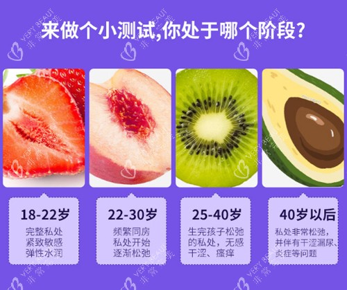 女性阴道松弛程度对比