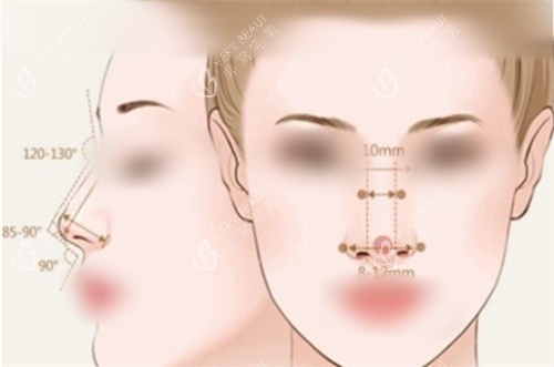 隆鼻后正面侧面展示图