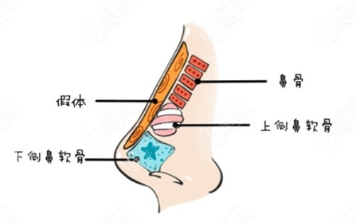 隆鼻动画解剖图 隆鼻动画解剖图
