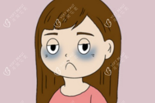 黑眼圈改善图片展示 黑眼圈改善图片展示