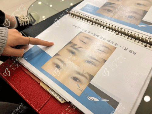 韩国世美整形手术实例图册