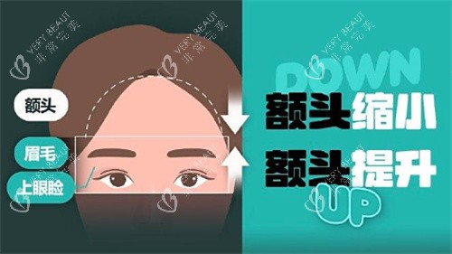 额头缩小和额头提升卡通 额头缩小和额头提升卡通