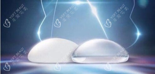 美国麦格娜绮丽假体 美国麦格娜绮丽假体