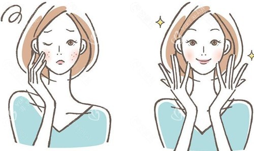 激光祛斑后的成效 激光祛斑后的成效