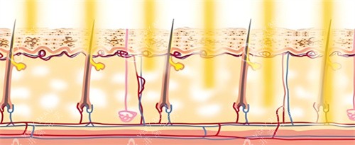 光子嫩肤作用图