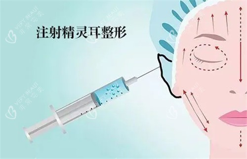 精灵耳注射动画图 精灵耳注射动画图