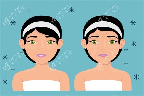 面部提升对比卡通图 面部提升对比卡通图