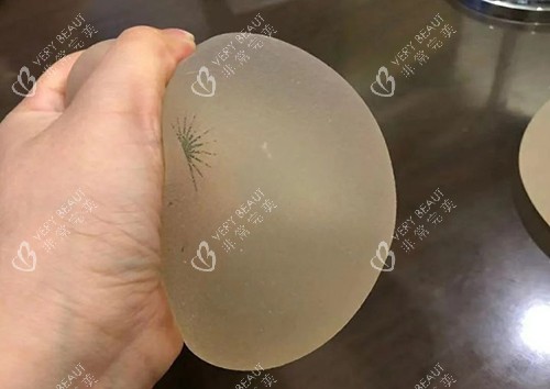 丰胸手术傲诺拉璀璨揉捏展示图 丰胸手术傲诺拉璀璨揉捏展示图