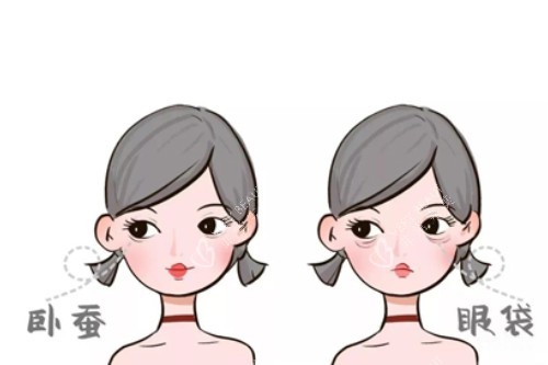 卧蚕、眼袋卡通对比图 卧蚕、眼袋卡通对比图
