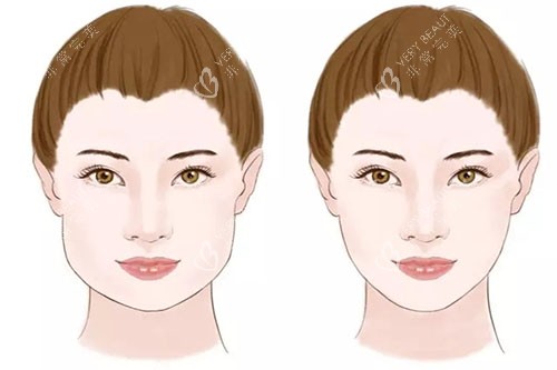 瘦脸卡通对比图 瘦脸卡通对比图