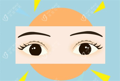 双眼皮手术注意事项 双眼皮手术注意事项