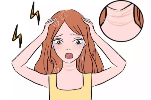 颈纹图片展示 颈纹图片展示