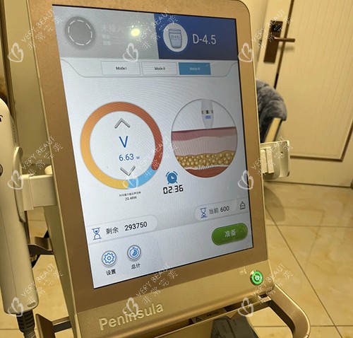 黄金超声炮 黄金超声炮