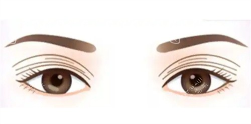 多眼皮示图 多眼皮示图