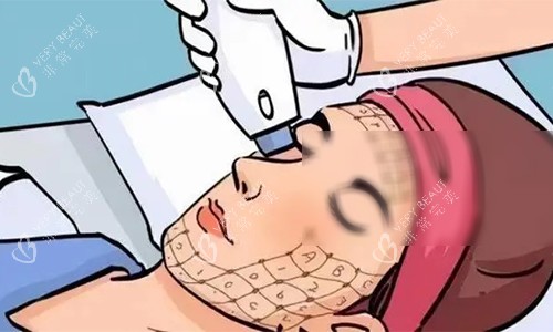 热玛吉的动画操作图 热玛吉的动画操作图