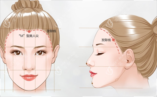 M型发际线素材 M型发际线素材