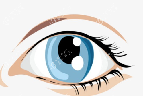 割双眼皮失败卡通图 割双眼皮失败卡通图