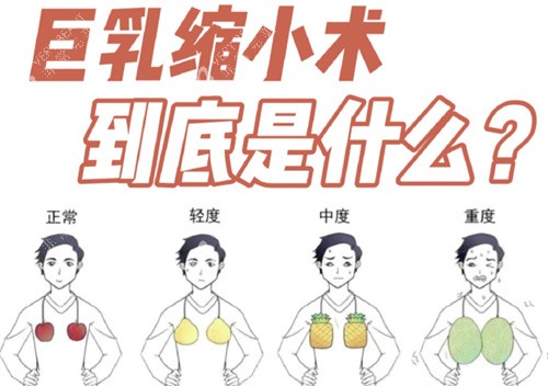 巨乳缩小术是什么