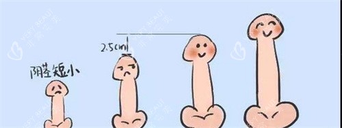 阴茎长度对比动画图 阴茎长度对比动画图