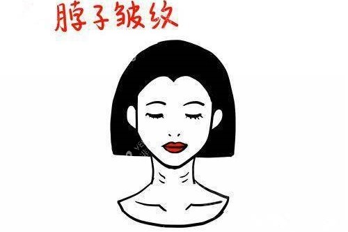 脖子皱纹卡通图