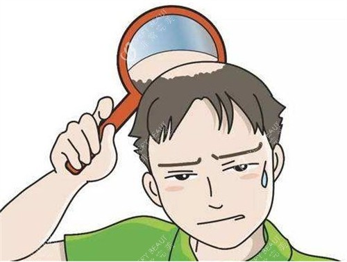 脂溢性脱发造成的困扰 脂溢性脱发造成的困扰
