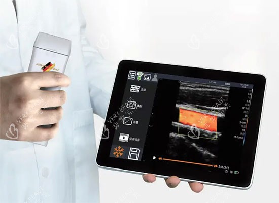 维密金雕检测脂肪层照片