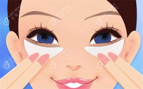 双眼皮术后卡通图 双眼皮术后卡通图