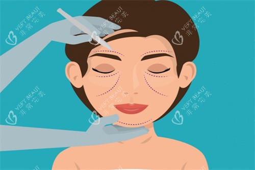 面部提升卡通图