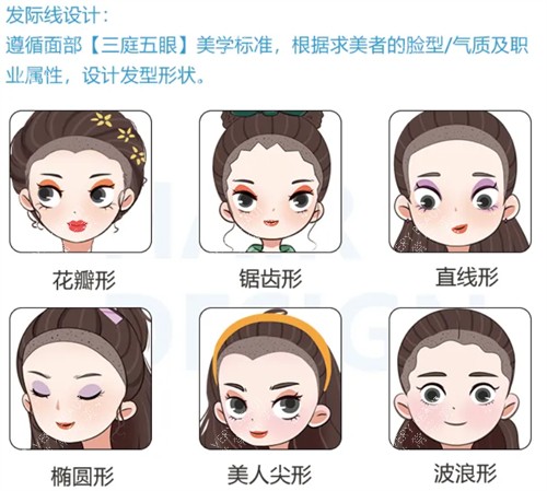 济南熙朵植发发际线种植优势介绍