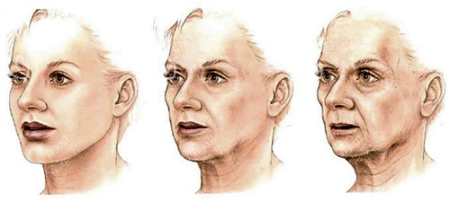 面部提升的皮肤前后对比