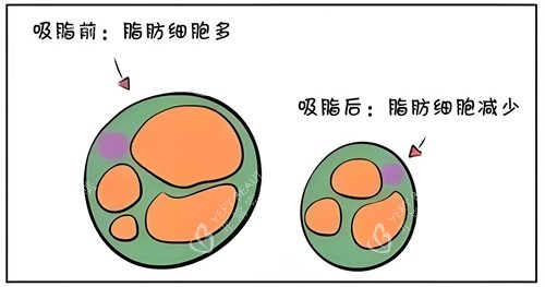 吸脂前后脂肪细胞对比动画图