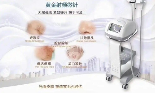 伊诺锶黄金微针治疗部位示意图