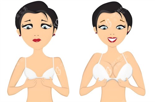 隆胸对比图