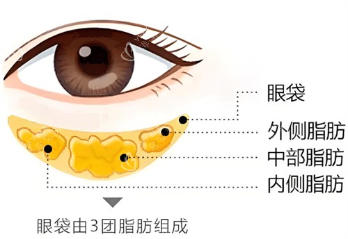 眼袋构成 眼袋构成